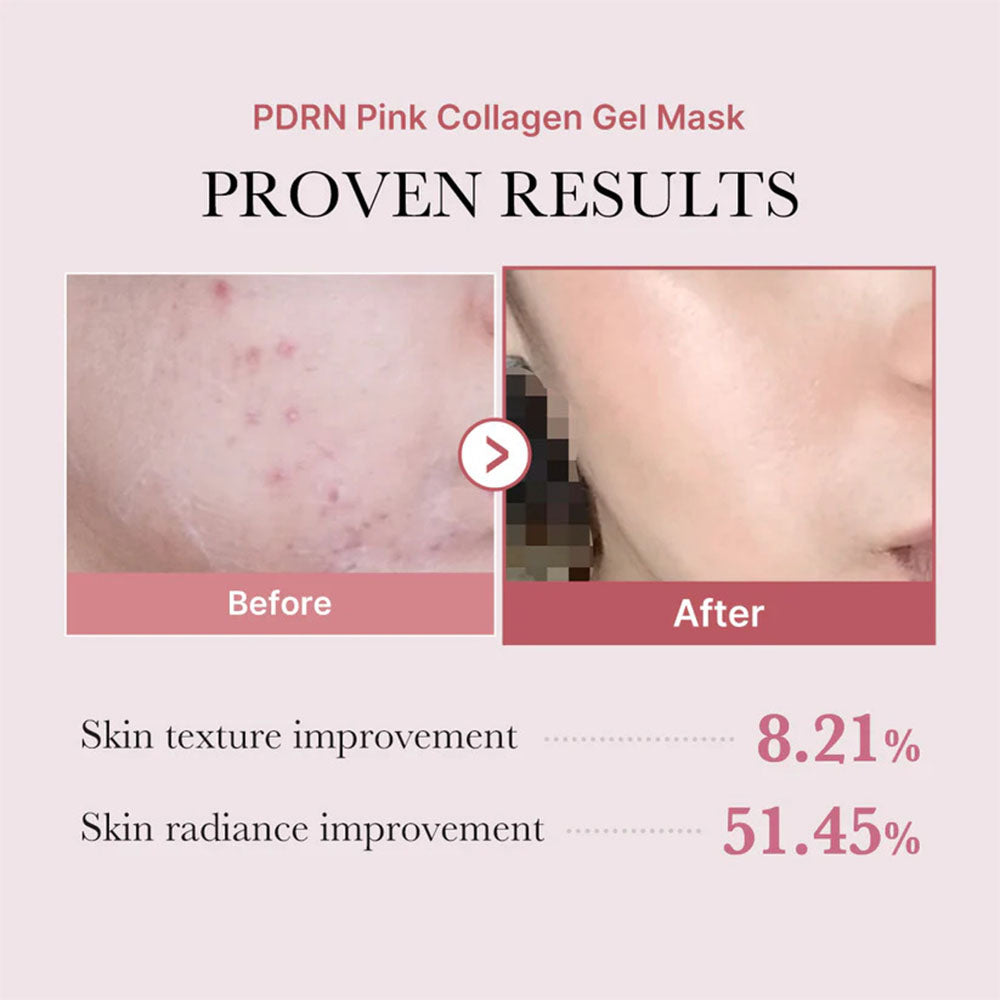 Salmon PDRN Collagen Mask