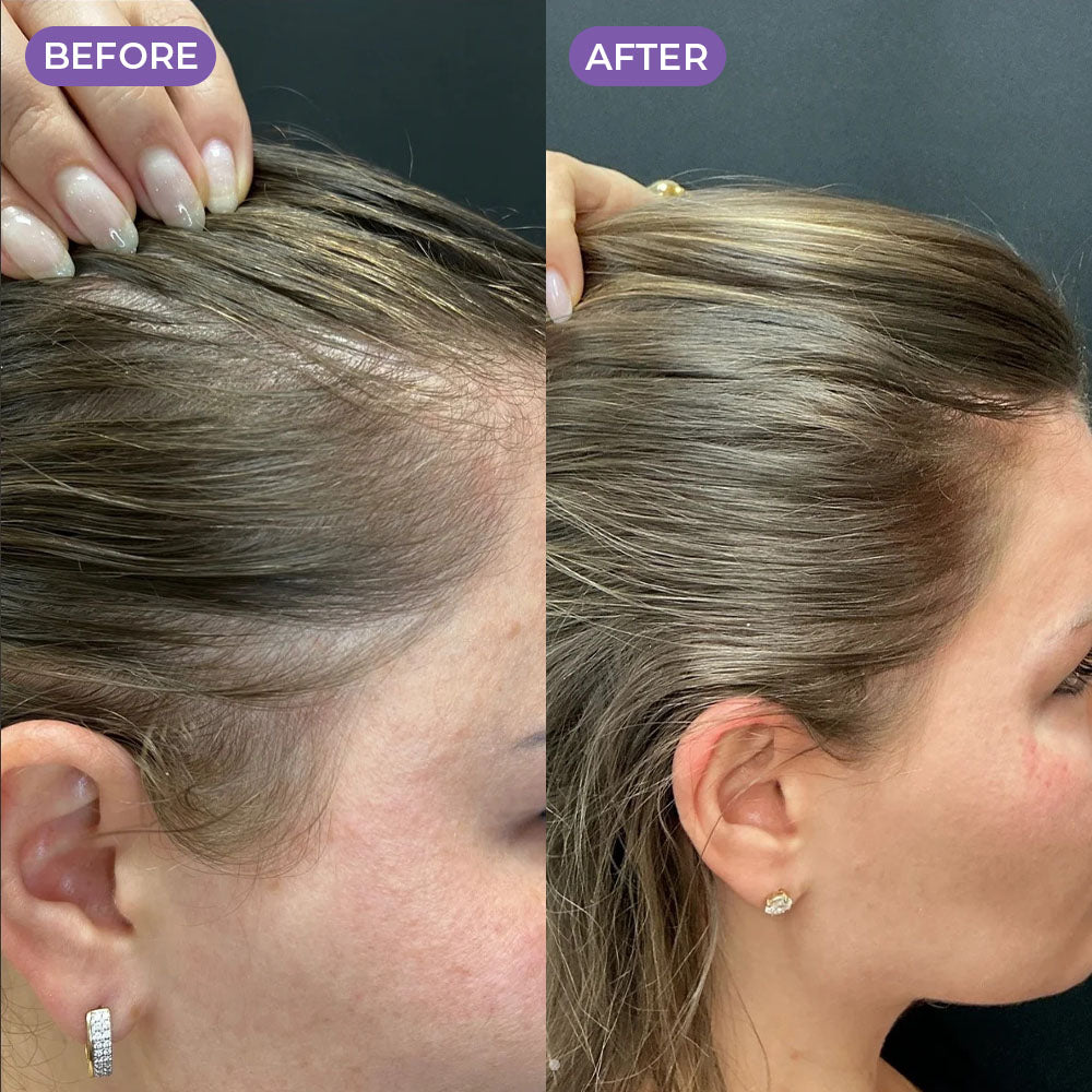Rosemary & Rice Water Hair Spray