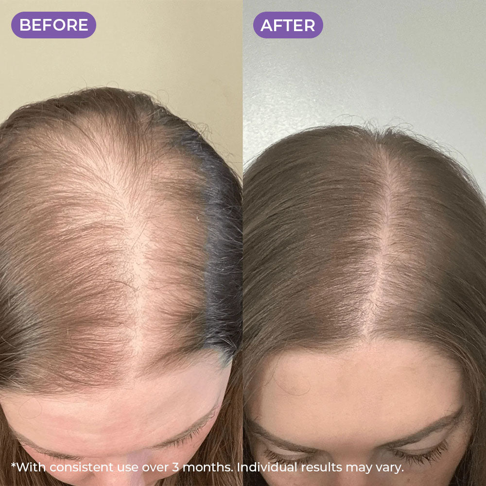 Rosemary & Rice Water Hair Spray