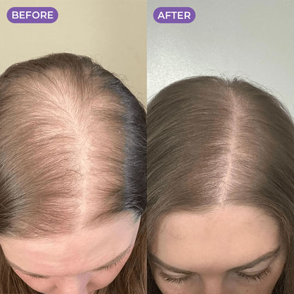 Rosemary & Rice Water Hair Spray