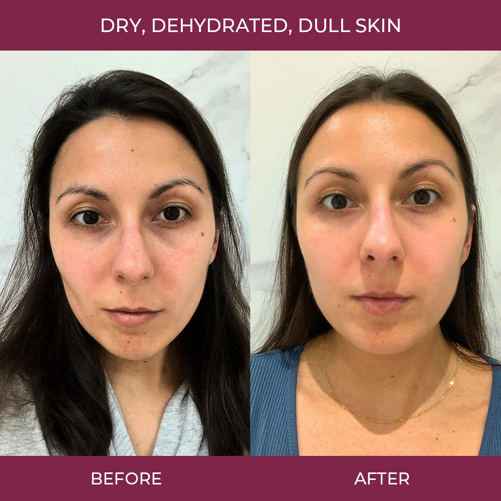 Salmon PDRN Collagen Mask