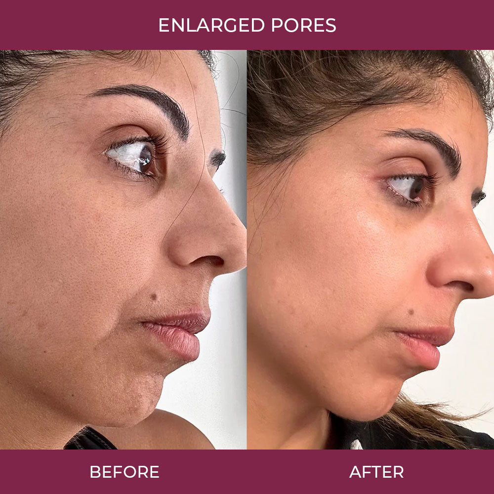 Salmon PDRN Collagen Mask