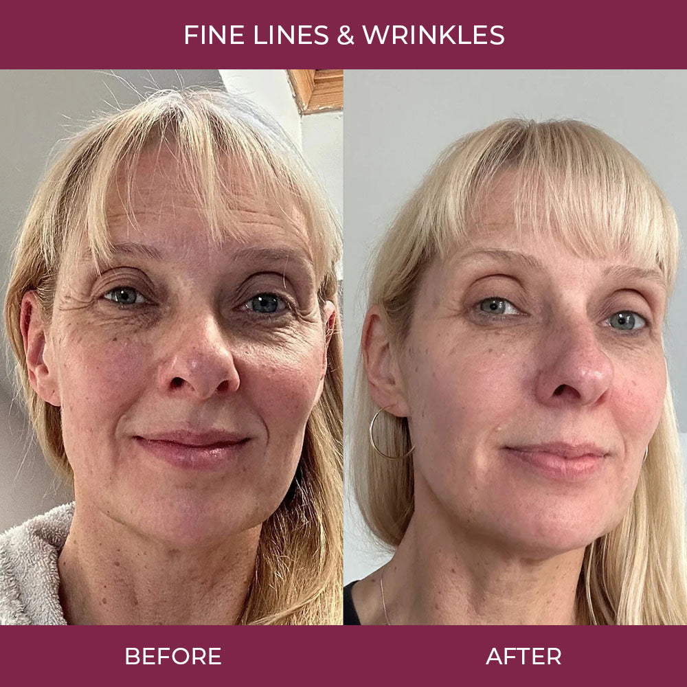 Salmon PDRN Collagen Mask