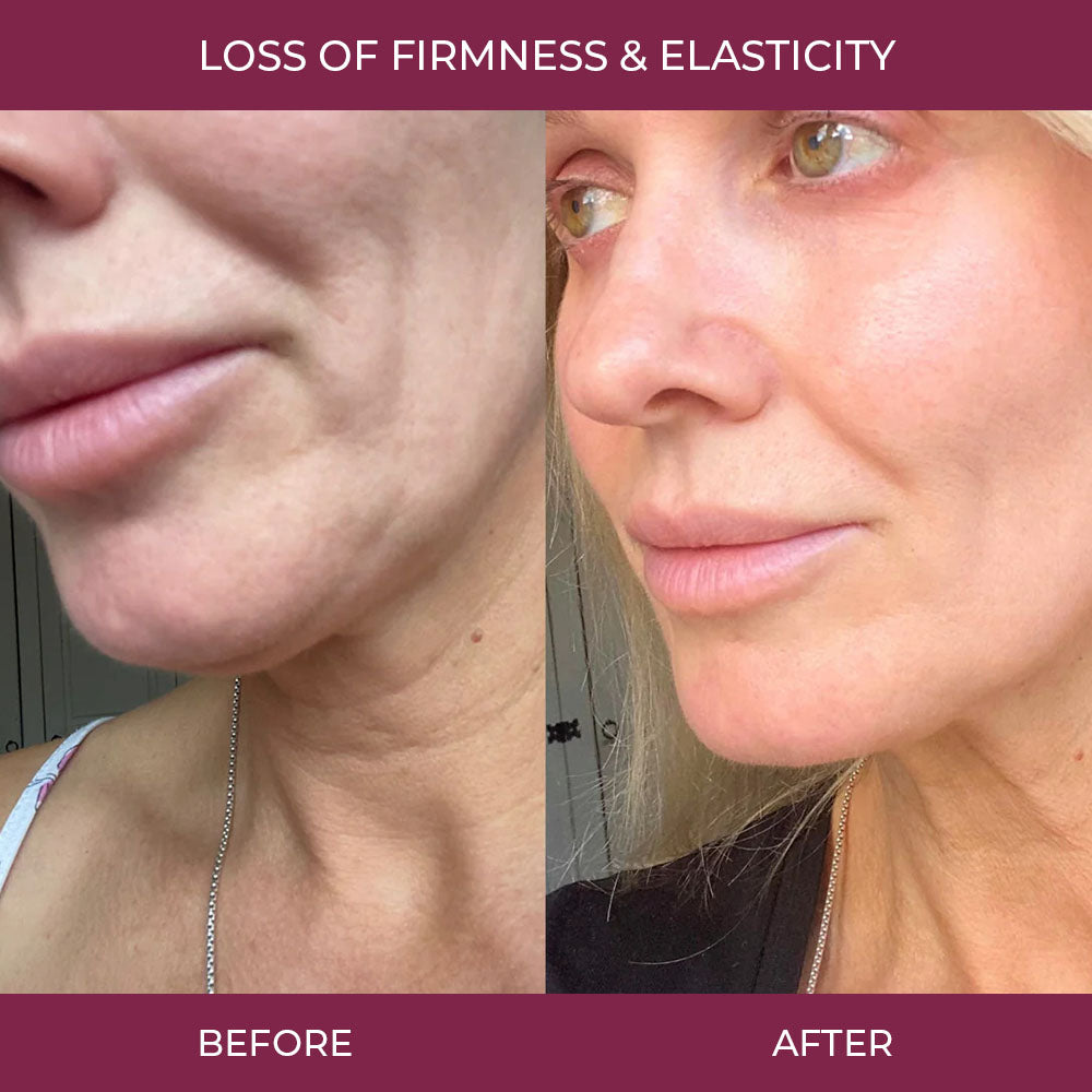 Salmon PDRN Collagen Mask