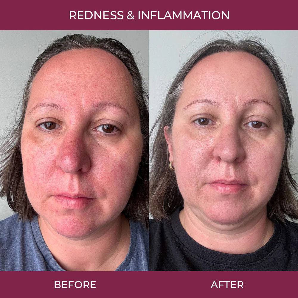 Salmon PDRN Collagen Mask