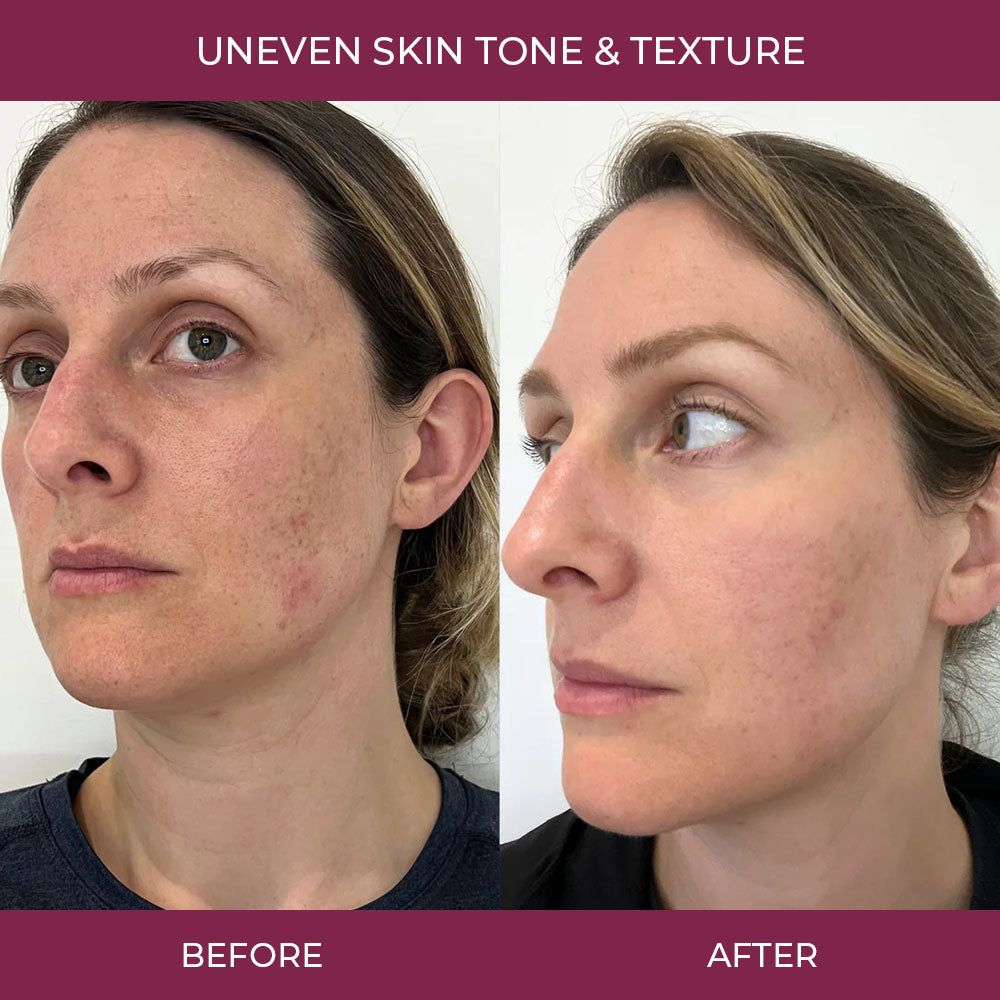 Salmon PDRN Collagen Mask